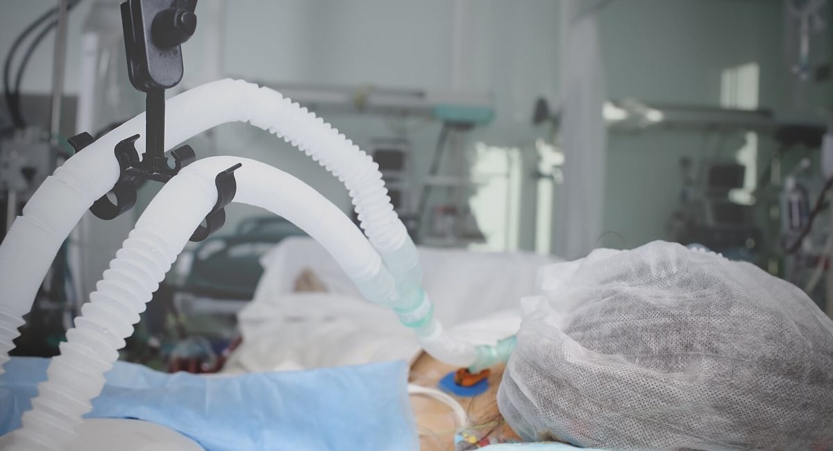 Image of tubing going toward a patient whose head is turned away from the camera.