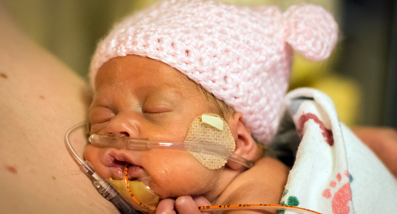 Published Approach to High Flow Nasal Cannula in Neonates | Vapotherm