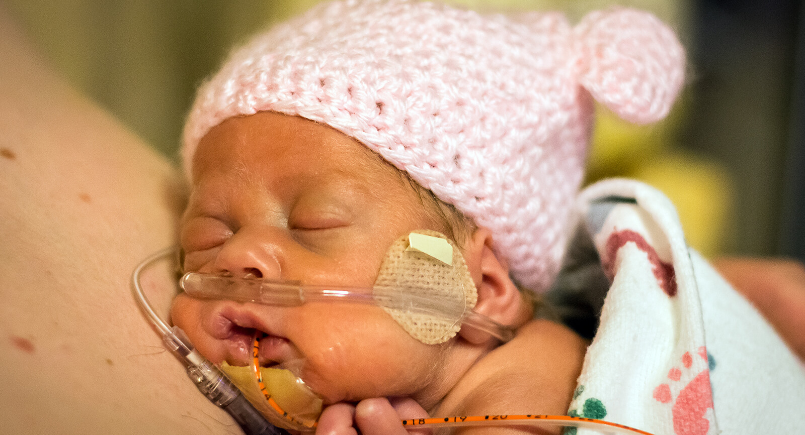 nasal cannula preemie